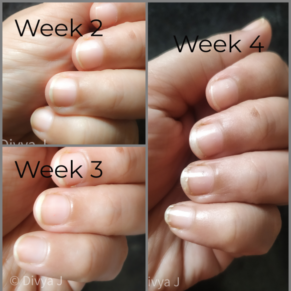 Nail Growth Status Week 4 and a Beginner nail art- 16 | blingnbangs